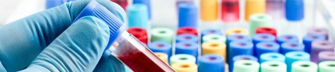 implantar un Sistema de Gestión de la Calidad bajo la Norma ISO 15189 en un laboratorio clínico_Grupo ACMS Consultores SISTEMA GESTIÓN ISO 15189